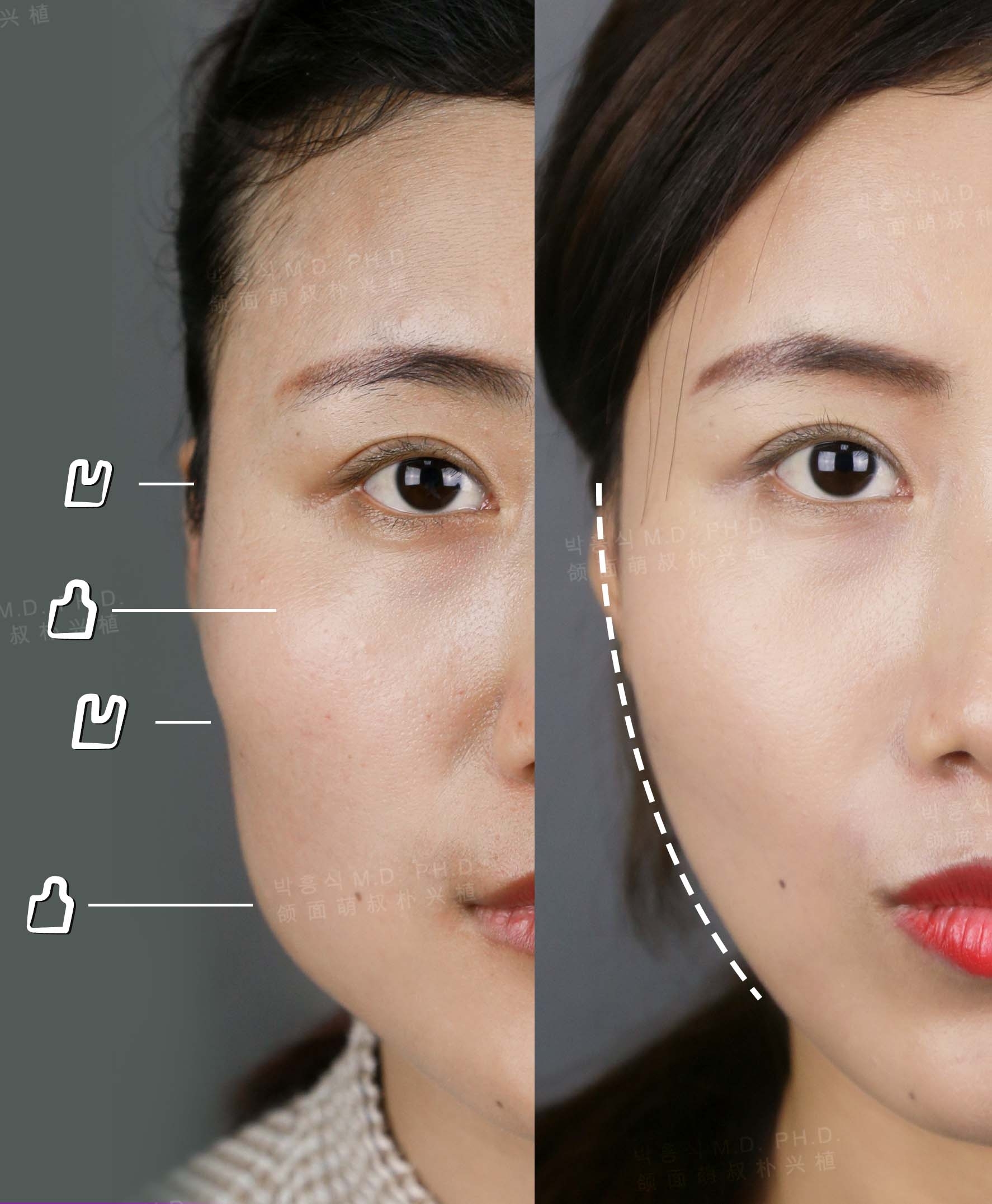 上海首爾麗格整形醫(yī)院詢問與預(yù)約，輕松開啟變得更美之旅