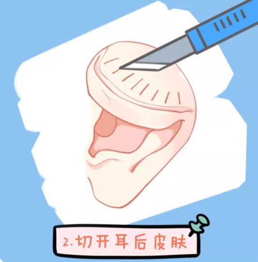 四、余文林醫(yī)生坐診信息與預(yù)約攻略