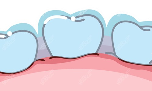 保護(hù)牙齒重要性 保護(hù)牙齒重要性