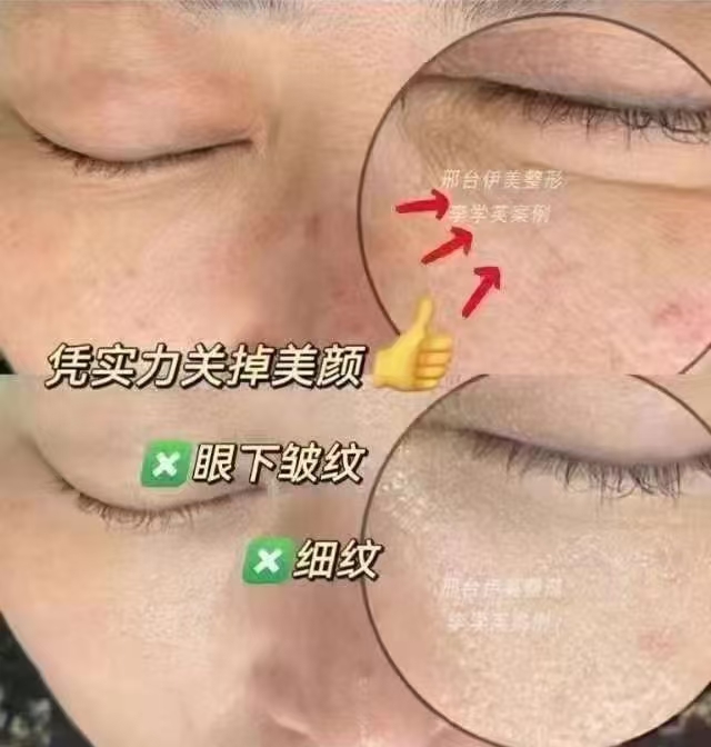 悅白之幾膠原蛋白的價(jià)格是多少？