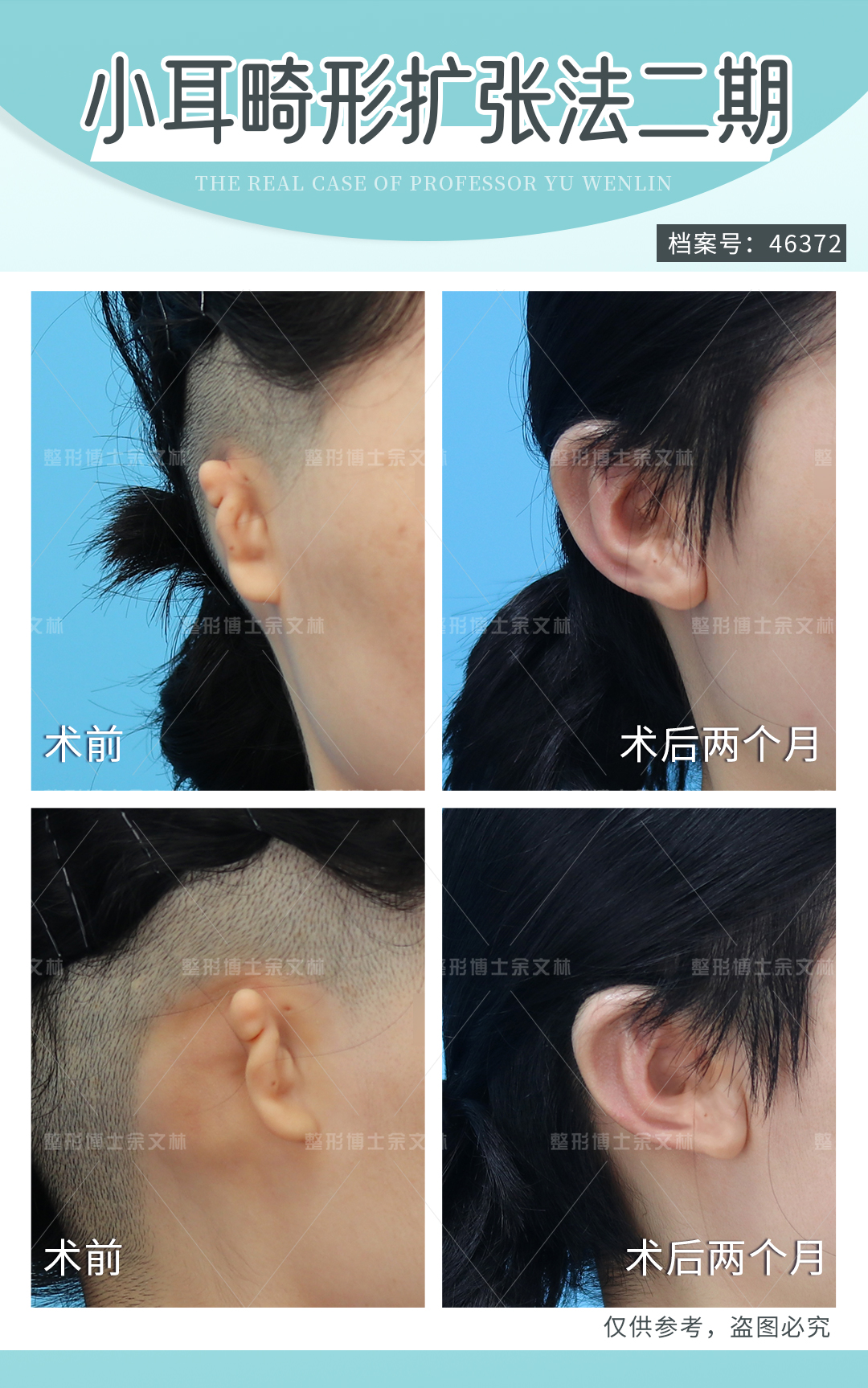 張?zhí)煊钺t(yī)生個(gè)人簡歷背景