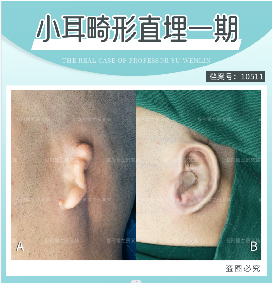 張?zhí)煊钺t(yī)生在業(yè)內(nèi)的地位與排名