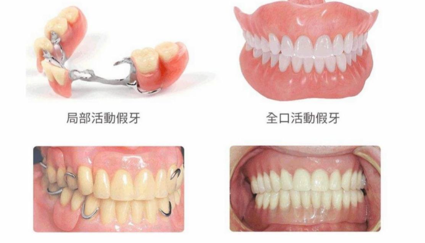 六、沈陽(yáng)歡樂(lè)口腔醫(yī)院——沈陽(yáng)吸附性義齒醫(yī)院推薦之家庭綜合服務(wù)www.sorencai.cn