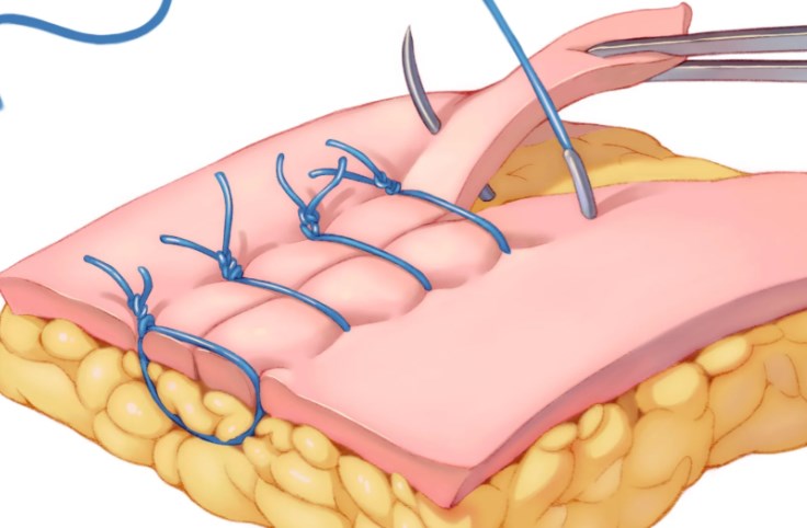 3.1 看擅長：按自己的需求選醫(yī)生