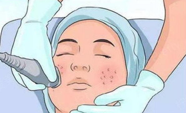 廈門哪里做點(diǎn)陣激光祛痘坑好？華美名媛、美萊、安黛美上榜！私立醫(yī)院名單公開超安心！