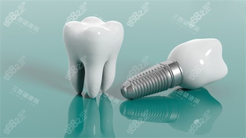 種植牙植體和牙冠漫畫示意圖