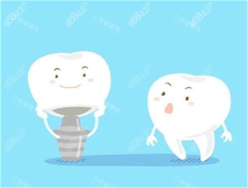 種植牙和健康牙對比圖