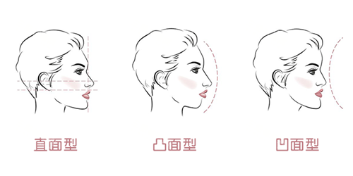 牙齒矯正面型問(wèn)題