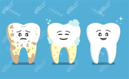 洗牙卡通