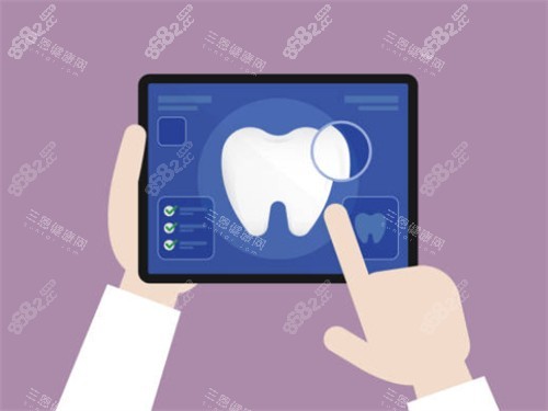 種植牙檢查平板圖