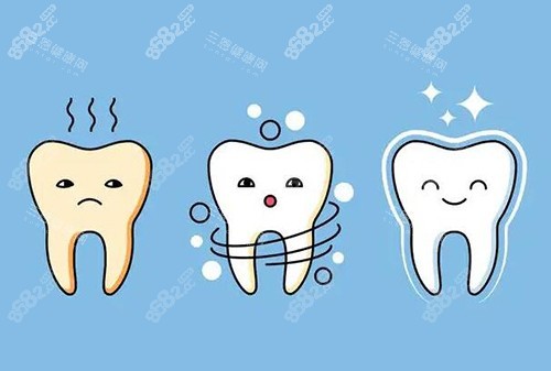 牙齒美白改善卡通圖展示