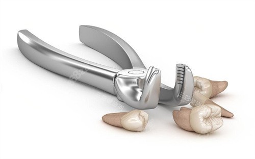 拔牙展示圖卡通 拔牙展示圖卡通