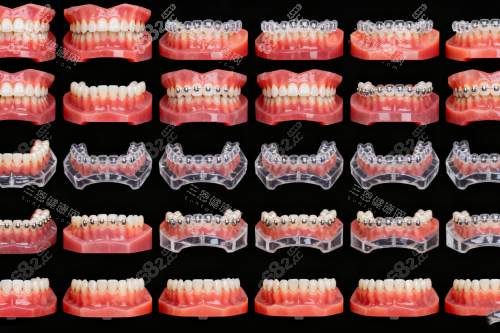 牙齒矯正步驟圖一覽