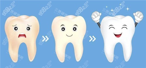 牙齒美白動(dòng)畫圖