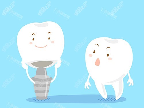 種植牙與真實牙齒漫畫圖