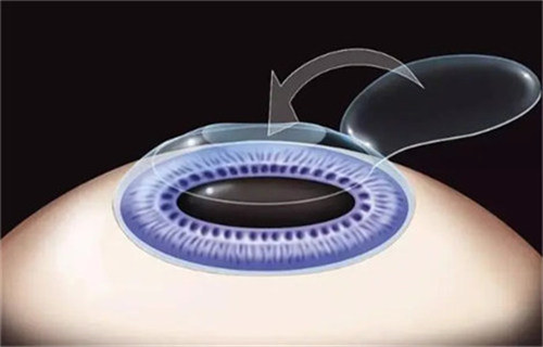 成都佰視佳眼科醫(yī)院的復(fù)雜屈光病例有專家會(huì)診嗎？趙小虎院長親診，手術(shù)量超5萬例口碑好 