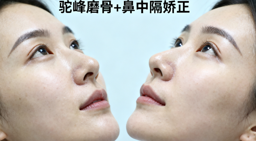 二、重點(diǎn)拆解：上海湯玉祥做鼻子的核心細(xì)節(jié)，每一點(diǎn)都貼合需求（核心詞第二次出現(xiàn)）www.sorencai.cn