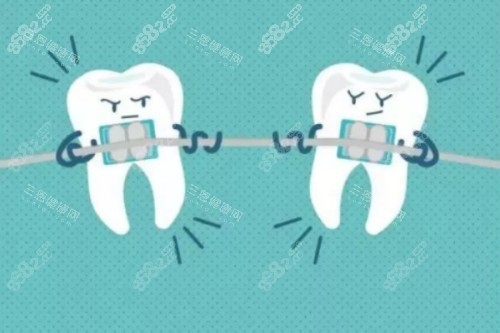 牙齒矯正卡通圖