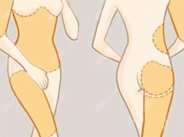 馮斌北京吸脂醫(yī)生簡介一覽表