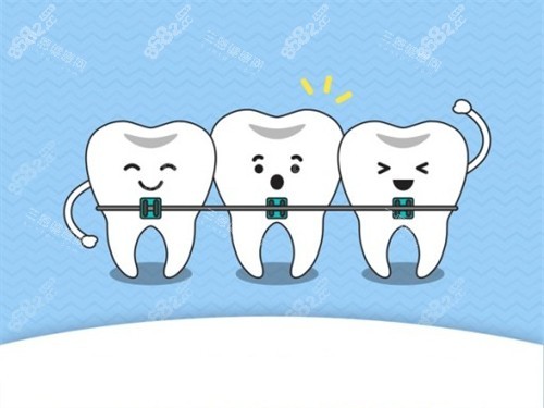 牙齒矯正動(dòng)畫示意圖