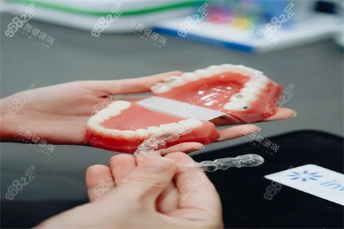 牙齒矯正宣傳圖