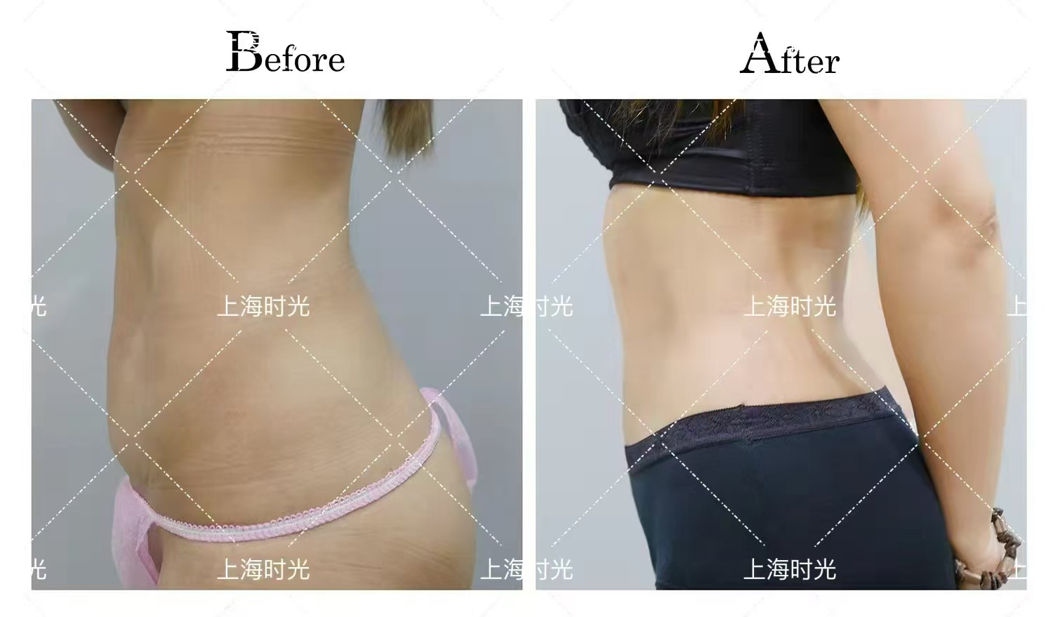 顧云鵬“分層抽吸”技術(shù)優(yōu)勢