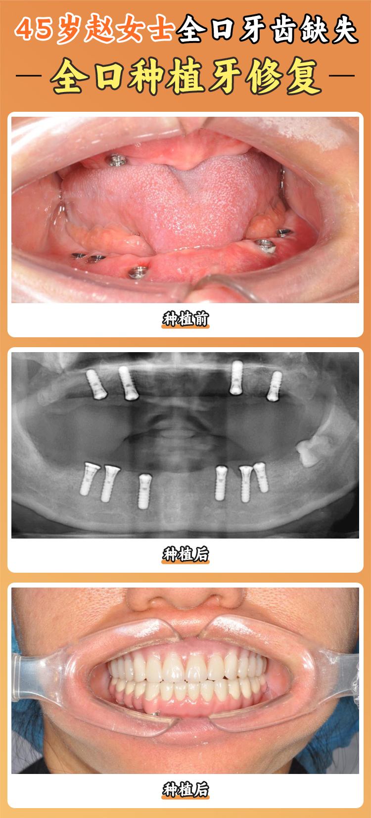一、萬維普惠口腔基本情況——種植是否可靠的基礎(chǔ)考量