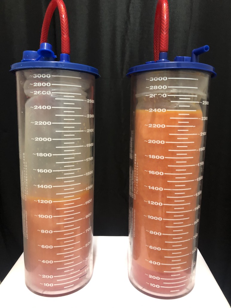 三、擅長(zhǎng)項(xiàng)目與實(shí)例分析