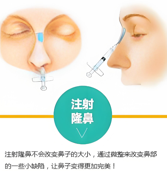 三、宮風(fēng)勇直鼻微翹就診攻略：掛號與變好期管理www.sorencai.cn