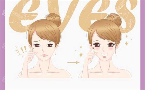 雙眼皮手術(shù)前后對(duì)比圖