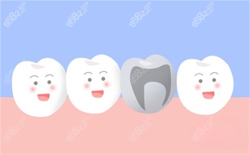 牙齒治療卡通圖片展示