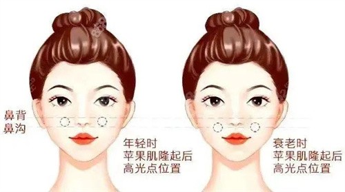 幼態(tài)臉面部平整度高