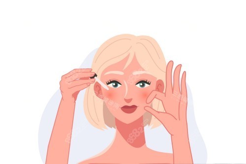 面部雙眼皮手術(shù)_