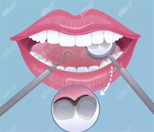 牙齒檢查卡通展示