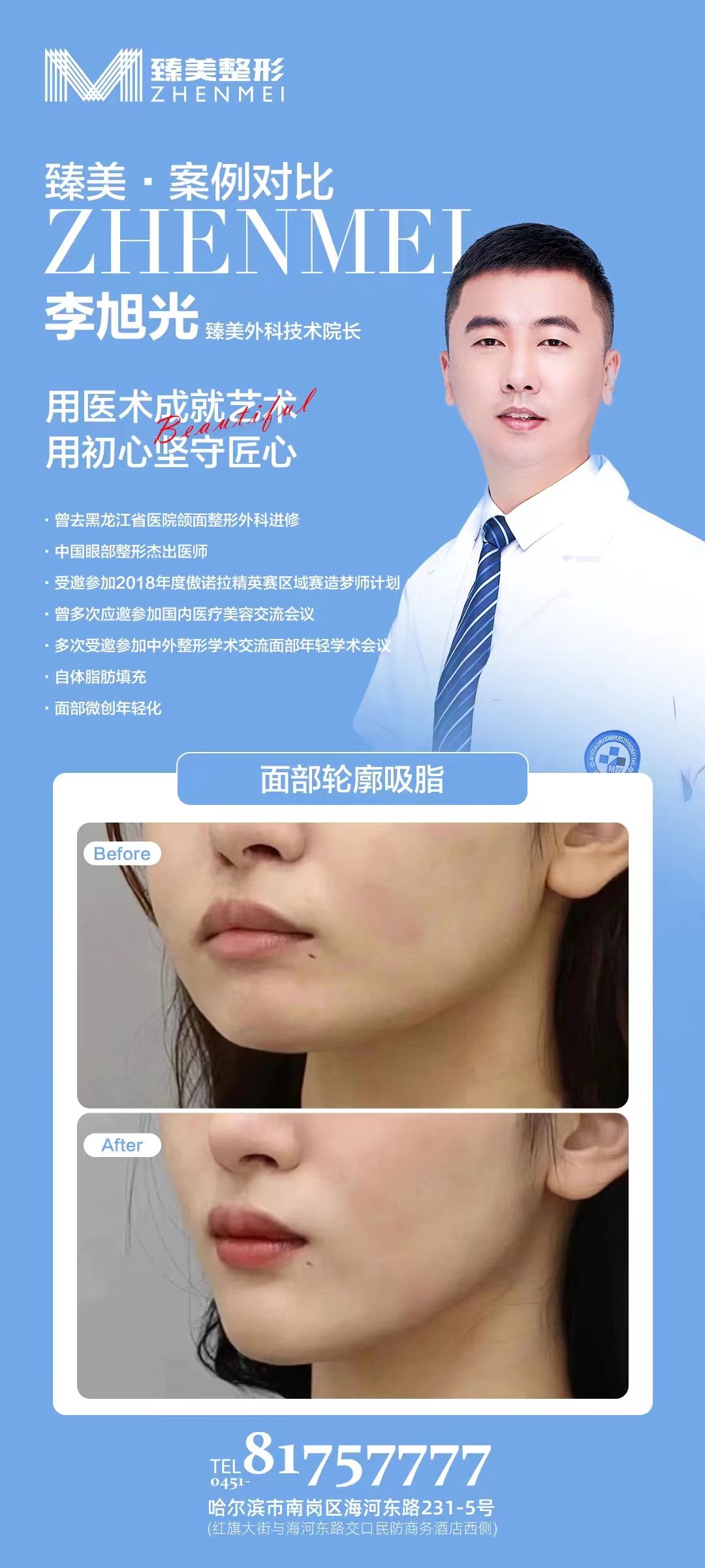 潘紅偉吸脂口碑究竟咋樣？25年經(jīng)驗院長，分層吸脂塑形，患者滿意度98% 