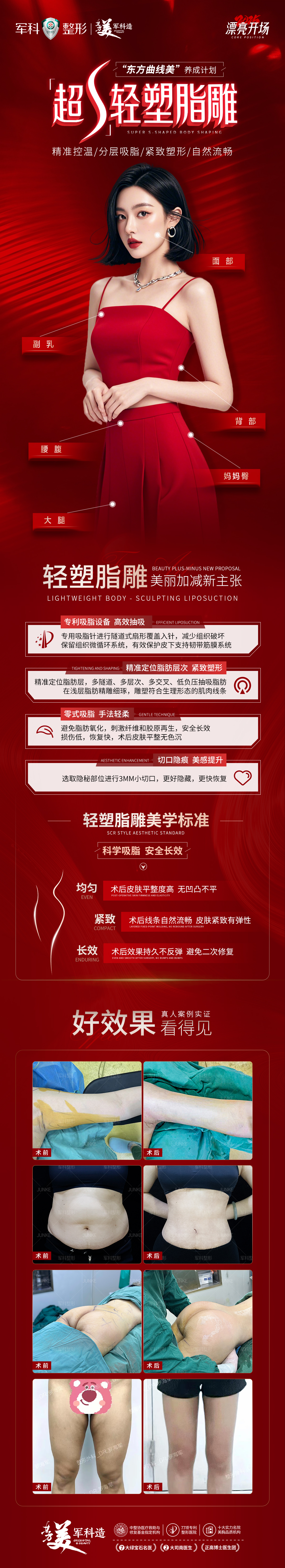 潘紅偉的分層吸脂塑形技術(shù)