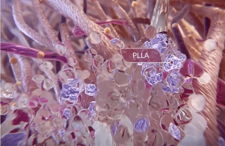 四、塑妍萃童顏針注射醫(yī)生推薦：真實(shí)粉絲反饋，不吹不黑www.sorencai.cn