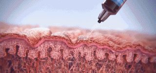 塑妍萃童顏針注射醫(yī)生推薦：國內(nèi)僅42位認(rèn)證醫(yī)師！這8位（含楊建國、郭江花）技術(shù)穩(wěn)又審美在線！