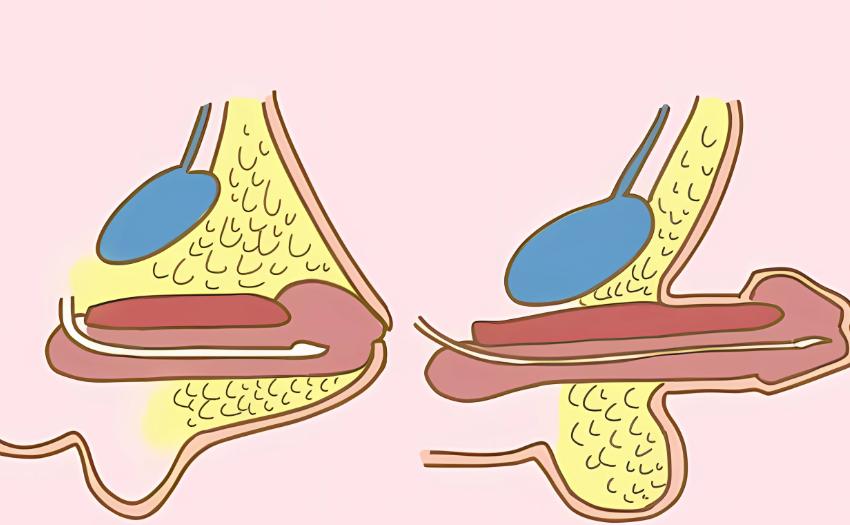 哈爾濱醫(yī) 科 大學(xué)附屬第四 醫(yī)院：設(shè)施齊全，經(jīng)驗多