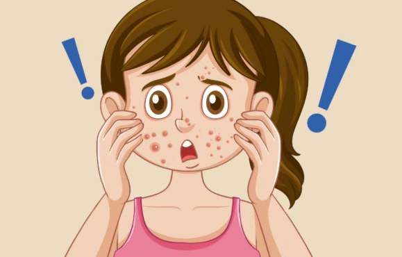 三、黃金微針和點陣激光治療特點對比www.sorencai.cn