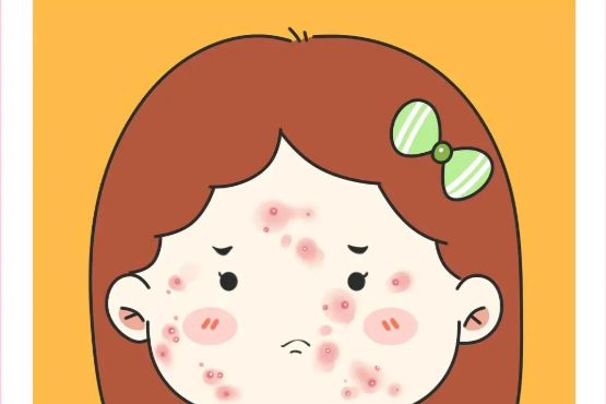 五、黃金微針和點陣激光治療建議