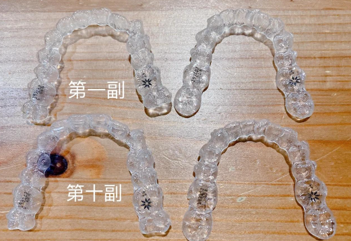 二、帶隱適美隱形牙套能吃飯的原理剖析