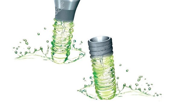 親水性種植牙照片