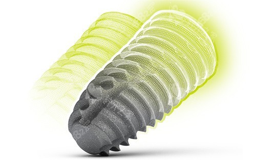 士卓曼種植牙圖片