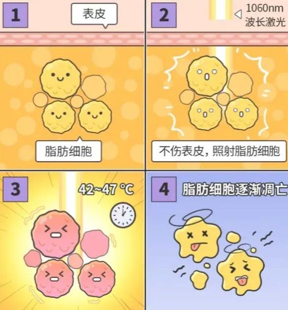 塑可秀激光溶脂怎么樣做一次效果好嗎？腰腹/大腿做一次，平均縮減3-5cm，無需節(jié)食也能見效果！