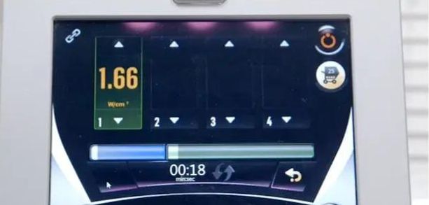 什么是塑可秀激光溶脂