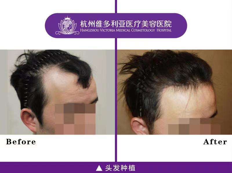 崔晶瑩醫(yī)生限量坐診，預(yù)約從速！