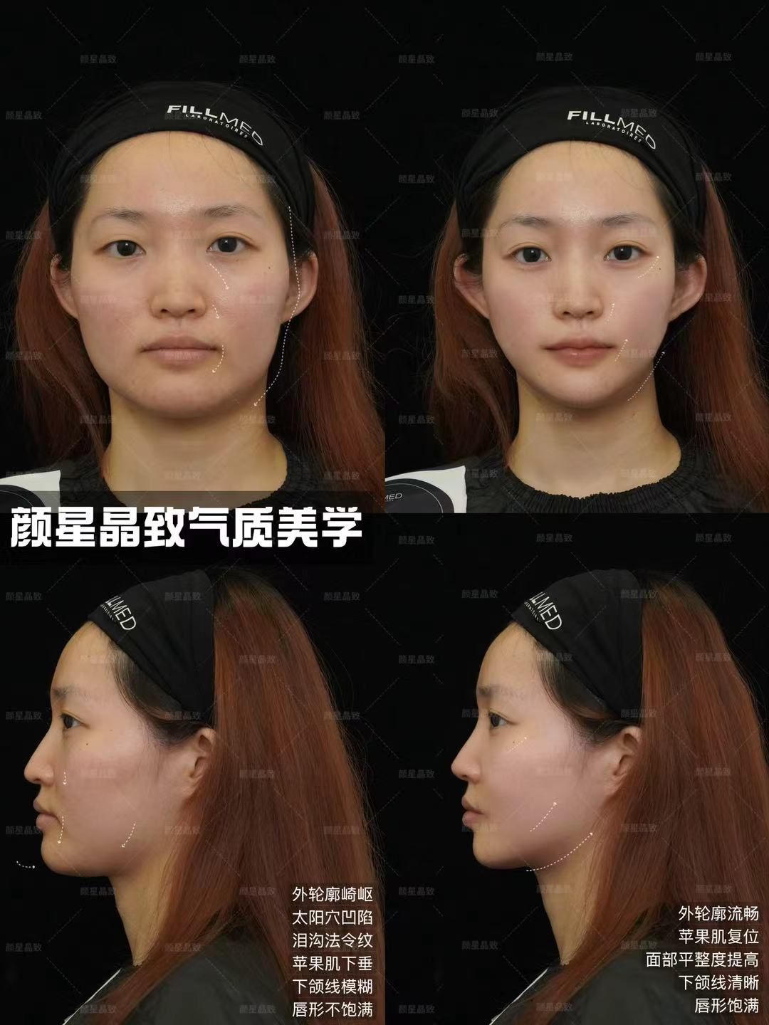 五、崔晶瑩醫(yī)生的技術(shù)優(yōu)勢有哪些？www.sorencai.cn