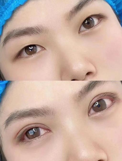 主力醫(yī)生：李芳