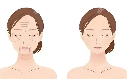 北京哪個醫(yī)生做外切眼袋修復好？推薦張冰潔、魏志香、李燕技術口碑雙收